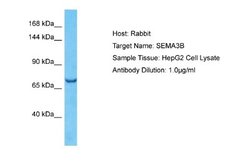 Semaphorin 3B Antibody, Novus Biologicals 100 &mu;L | Buy Online | Novus Biologicals | Fisher Scientific